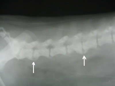 Spondylóza na chrbtici
