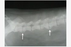 Spondylóza na chrbtici